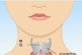 一般甲状腺结节分为哪几类？图片