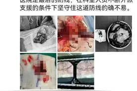 死亡率非常高！76岁大伯深夜腹痛竟是凶险疾病，医生：这类人群要特别小心图片