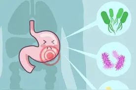 这种胃癌的“危险因素”，一篇教你如何根除治疗！图片