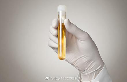 做尿常规一定要用晨尿吗（尿检时）