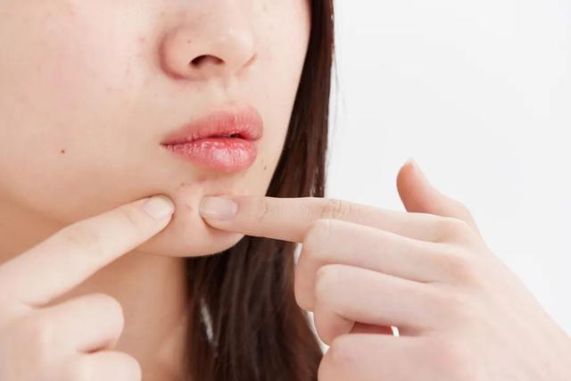 警惕!眼睛周围长了小疙瘩,千万别挤,小心与hpv病毒相关