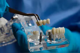 史上最难集采落地：种牙大降价，走了第一步图片