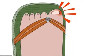 孩子突然厌学，病因居然在脚上？医生：并不少见！图片