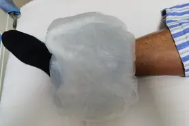 健康科普 | 不小心崴了脚，这样做就对了图片