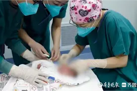 早产儿视网膜病变有失明风险，手术治疗后视网膜恢复正常发育图片