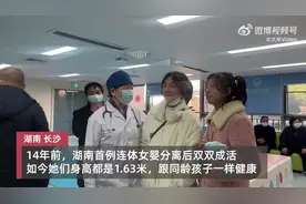 真好！连体女婴手术14年后长成健康少女图片