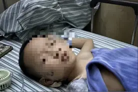 男童被邻居扔鞭炮炸伤手臂截肢，家属透露新进展！警方回应图片