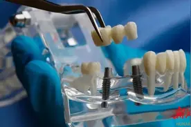 好消息，长沙市口腔医院同步落实种植牙全流程医疗服务价格调控！手术价格平均下降3000到5000元图片