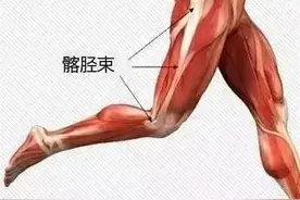 为什么会发生髂胫束摩擦综合征？图片