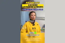 男孩不慎跌入灶台全身多处烧伤 将在医院度过他的十岁生日图片