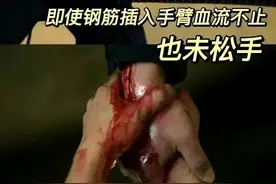 《狂飙》安欣的右手被钢筋扎穿，当异物贯穿身体怎么办？图片