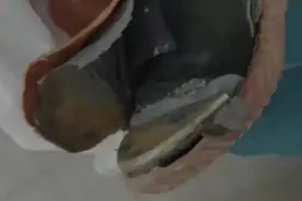 果然视频|重物砸鞋，一男子被鞋内钢板夹住脚图片