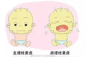 新生儿黄疸不可轻视图片