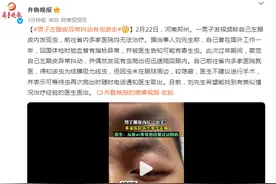 男子眼皮内长“虫子”，多家医院束手无策，医生：从业40多年没见过…图片