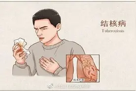 结核病有哪些症状？图片