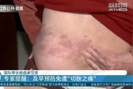 什么是带状疱疹？如何预防？一文了解→图片