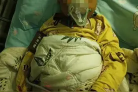 西安“红薯爸爸救子”续：“小红薯”已度过危险期图片