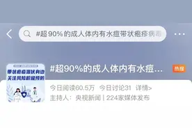 熬夜三天，28 岁小伙痛到想撞墙！小心这种病毒，一旦感染终身携带！图片