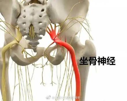 坐骨神经是哪里（什么是坐骨神经）