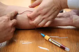 为啥生病到医院先验血？哪些检查必须空腹抽血？一次性说清楚了！图片