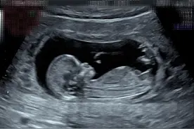 Selina任家萱宣布怀孕，孩子小名叫腰果图片