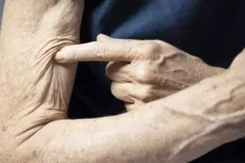 老年人需警惕肌肉衰减症图片