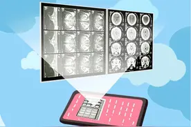 多地上线“云胶片”服务，破解全国统一电子病历难题图片