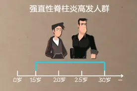 明星也无法摆脱的“痛”——强直性脊柱炎图片