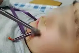 追逐打闹时这种玩具刺入男孩面部……学校附近很多商店有售→图片