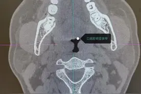 30岁男子三年来每晚“尿床”竟是打鼾惹的祸图片