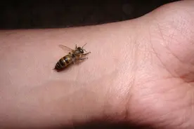 钱报健康小站 | 女子被蜂蜇伤紧急入院，春季这事高发，第一时间要这么做图片