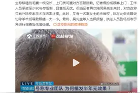 存活率95%至99%？男子花钱遭罪植发半年后一根没长图片