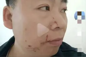 男网红AI“换脸”合成与迪丽热巴亲吻视频被打图片