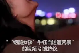 钢腿女孩发文喊话网暴者：杀不死我的只会让我更强大，我不会让你们赢图片