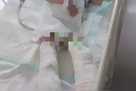 “生母虐待5岁儿子致截肢”引关注！妇联称其已被警方控制图片
