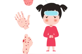 临沂疾控最新提醒！这些疾病进入高发期图片