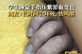学生趴着睡觉手指变紫！网友直呼快叫醒图片