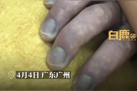 学生趴着睡觉手指变紫！网友直呼快叫醒图片
