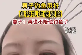 哭笑不得！男子钓鱼甩杆鱼钩扎进老婆脸，妻子：再也不陪他钓鱼了图片