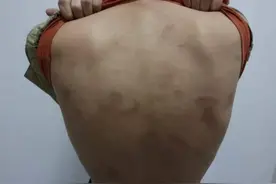 落入境外电诈陷阱的人究竟过着怎样生活？回国自首男子讲述在缅遭遇图片