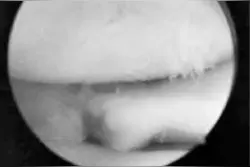 60岁那年 赵阿姨连爬了7天千山 从此再也不敢多走路图片