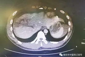 车祸、肝破裂、大出血……危急时刻潍坊市中医院专家抢救化险为夷图片