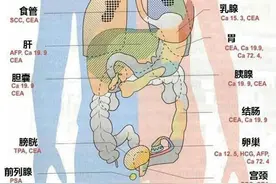 全国肿瘤防治宣传周｜如何看懂肿瘤标志物 哪些人需定期筛查图片