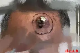 太突然，癌变！医生：这些情况赶紧就医图片
