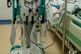 英德市浛洸镇中心卫生院开展首例CRRT治疗图片