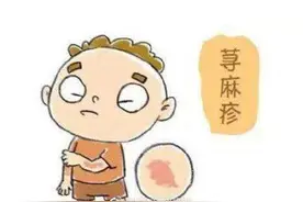 慢性荨麻疹如何治疗？图片