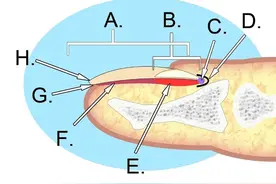 指甲剪短显得干净？小心甲沟炎找上门！正确剪指甲只需这2步→图片