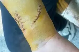 果然视频|11岁男娃被托管班玻璃门割伤 赔偿问题引纠纷图片