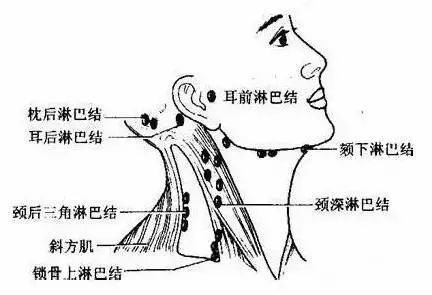 脖子上的淋巴结肿大会疼吗（警惕颈部淋巴结肿大）