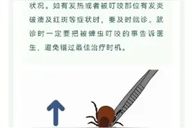 五一出游存好这些知识点：被蜱虫咬了该怎么办？图片